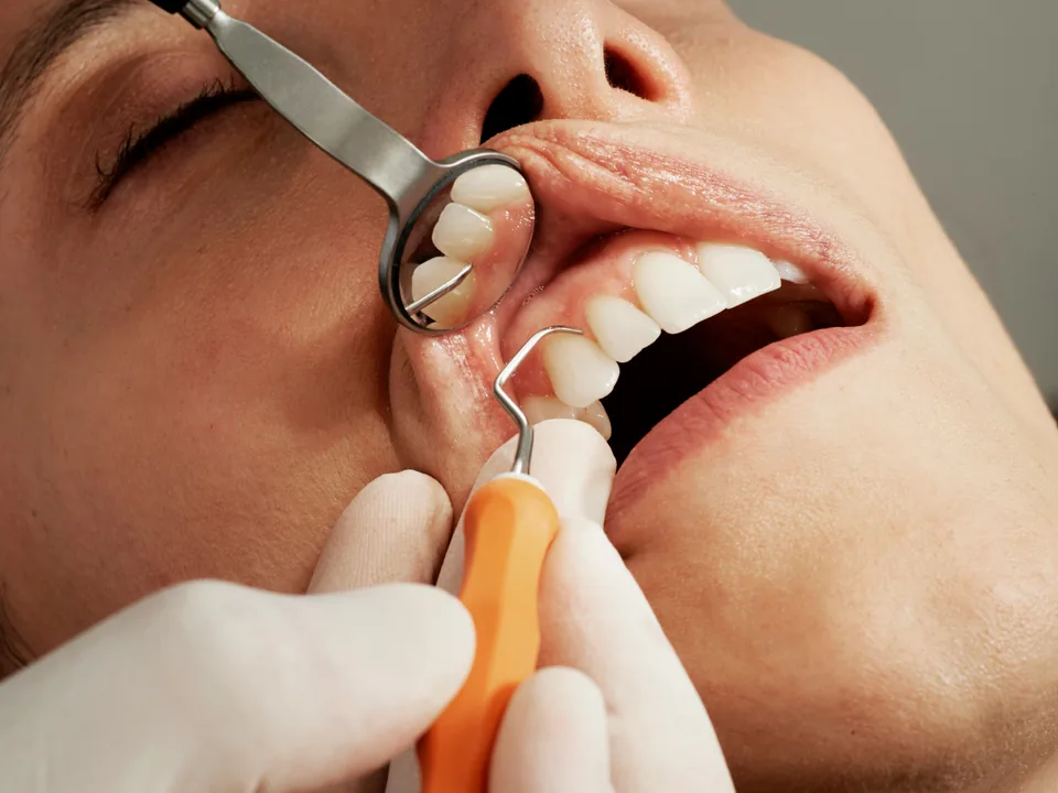 Dental examination using a mirror and probe to check the teeth