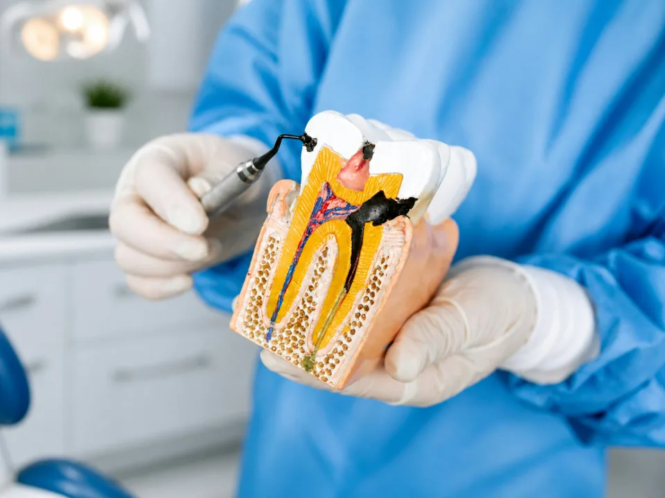 Clinician demonstrating decay and the inside of a tooth using a cutaway dental model